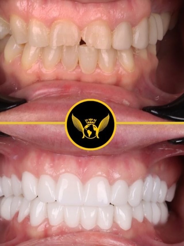 Dental